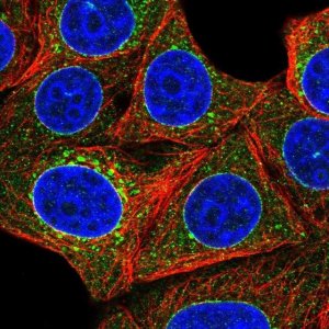 Anti-TOR1A antibody produced in rabbit 