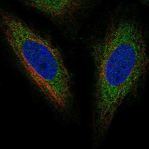 Anti-TOR1AIP2 antibody produced in rabbit 