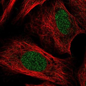 Anti-TOX antibody produced in rabbit 