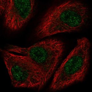 Anti-TOX2 antibody produced in rabbit 