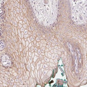 Anti-TP53AIP1 antibody produced in rabbit 