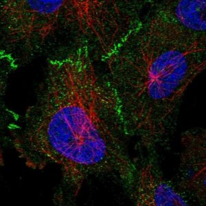 Anti-TP53BP2 antibody produced in rabbit 