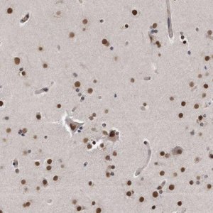 Anti-TP53INP1 antibody produced in rabbit 
