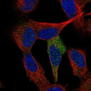 Anti-TP53INP1 antibody produced in rabbit 