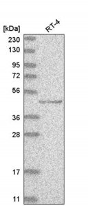 Anti-TP73 antibody produced in rabbit HPA027314-100UL