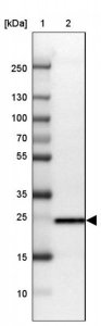 Anti-TPD52L1 antibody produced in rabbit HPA027915-100UL