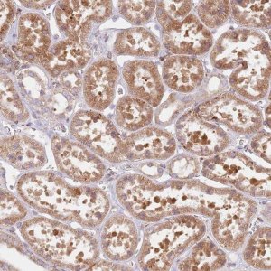 Anti-TPD52L2 antibody produced in rabbit HPA047489-100UL