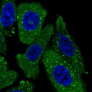 Anti-TPD52L2 antibody produced in rabbit HPA047489-100UL