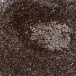 Anti-TPK1 antibody produced in rabbit 