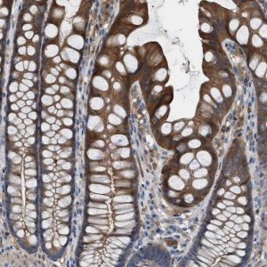 Anti-TPK1 antibody produced in rabbit 