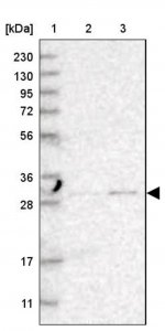 Anti-TPMT antibody produced in rabbit 