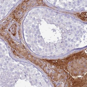 Anti-TPPP3 antibody produced in rabbit 