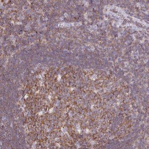 Anti-TPRG1 antibody produced in rabbit 