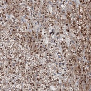 Anti-TPRKB antibody produced in rabbit 