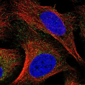 Anti-TPRKB antibody produced in rabbit 
