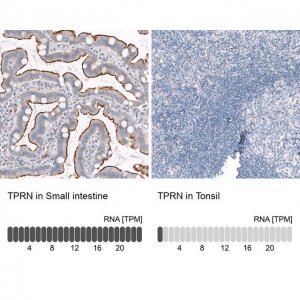 ANTI-TPRN antibody produced in rabbit 