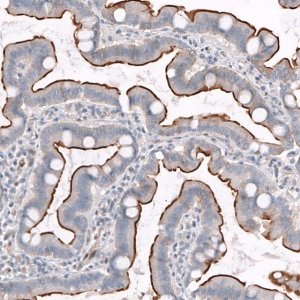 ANTI-TPRN antibody produced in rabbit 