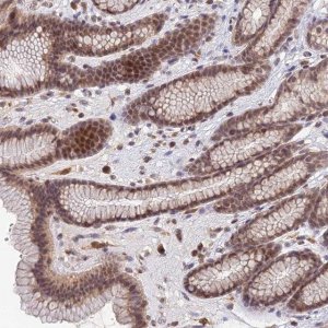 Anti-TPRX1 antibody produced in rabbit 