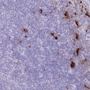 Anti-TPSB2 antibody produced in rabbit 