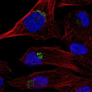 Anti-TPST1 antibody produced in rabbit 