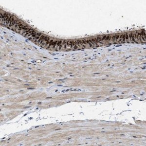 Anti-TPST2 antibody produced in rabbit 