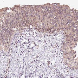 Anti-TPT1 antibody produced in rabbit HPA039437-100UL