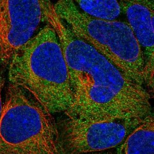 Anti-TPT1 antibody produced in rabbit HPA039437-100UL