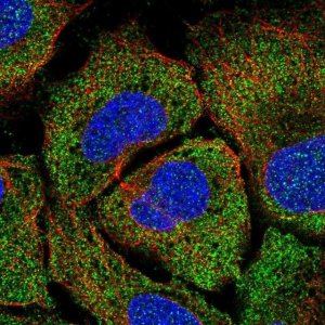 Anti-TPTE2 antibody produced in rabbit 