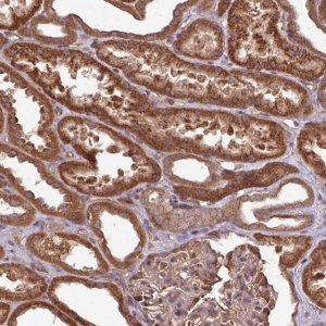 Anti-TRABD2B antibody produced in rabbit 