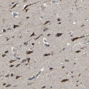 Anti-TRAK1 antibody produced in rabbit 