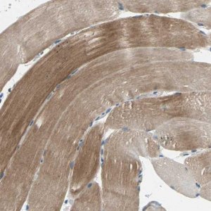 Anti-TRAK1 antibody produced in rabbit 