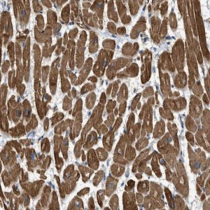 Anti-TRAK2 antibody produced in rabbit 