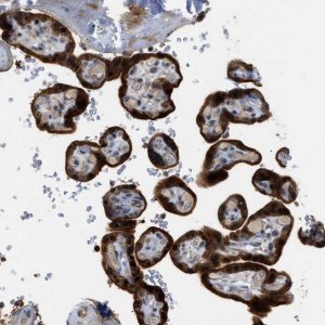Anti-TRAK2 antibody produced in rabbit 