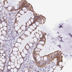 Anti-TRAM2 antibody produced in rabbit 