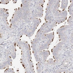 Anti-TRANK1 antibody produced in rabbit 
