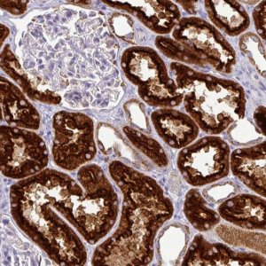 Anti-TRAPPC1 antibody produced in rabbit 