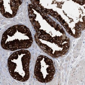 Anti-TRAPPC13 antibody produced in rabbit 