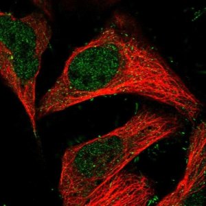 Anti-TRAPPC13 antibody produced in rabbit 