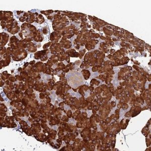 Anti-TRAPPC6A antibody produced in rabbit 
