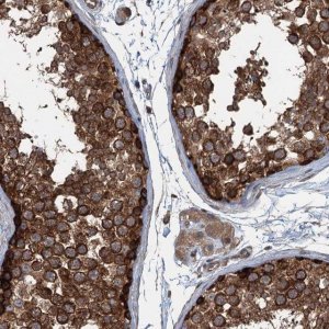 Anti-TRAPPC8 antibody produced in rabbit 