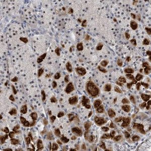 Anti-TRDMT1 antibody produced in rabbit 