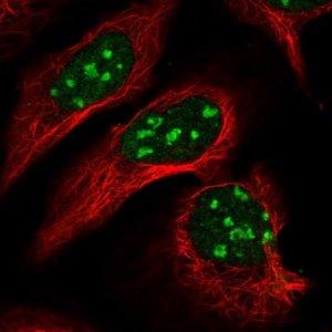 Anti-TRDMT1 antibody produced in rabbit 