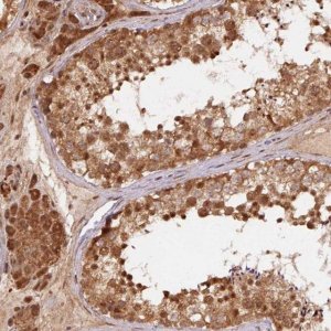 Anti-TREML4 antibody produced in rabbit 