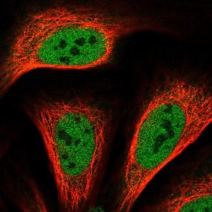 Anti-TRERF1 antibody produced in rabbit 