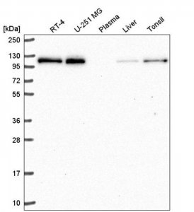 Anti-TRERF1 antibody produced in rabbit 