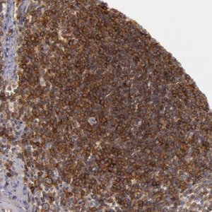 Anti-TRIB2 antibody produced in rabbit 
