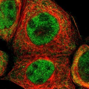 Anti-TRIB2 antibody produced in rabbit 