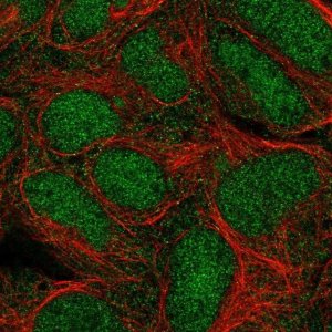 Anti-TRIM11 antibody produced in rabbit 