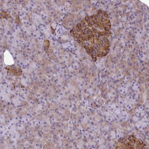 Anti-TRIM17 antibody produced in rabbit 