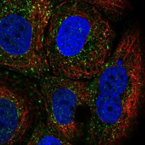 Anti-TRIM17 antibody produced in rabbit 